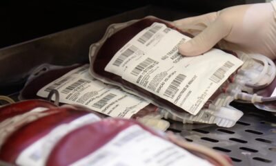 doações, sanguíneas, coleta, de sangue, hemoterapia;